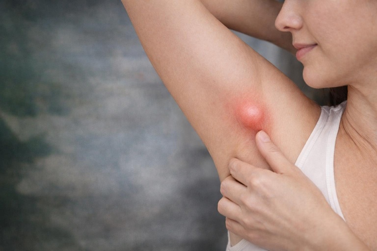 Koltuk altındaki şişlik her zaman masum değil